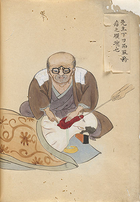 This is a picture from Hanaoka Seishu's work, "Surgical Casebook". It is a part of the National Library of Medicine's "Turning the Pages" project, which digitizes older medical texts that should no longer be handled in physical form.
